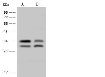 Polyclonal Rabbit anti-Human TIP30 / HTATIP2 Antibody (IHC, WB)