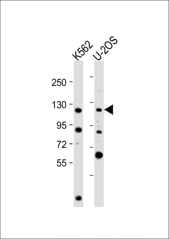 NOP2 Antibody (N-Terminus)