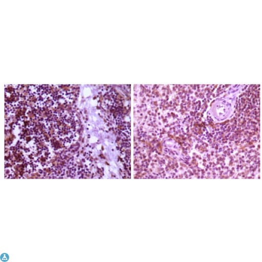 MAP2K4 / MKK4 Antibody