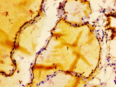 Recombinant Monoclonal Rabbit anti-Human BCL2 / Bcl-2 Antibody (IHC, WB)