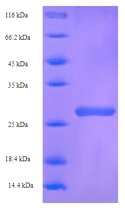 Bovine B4GALT1 Protein (Recombinant GST)