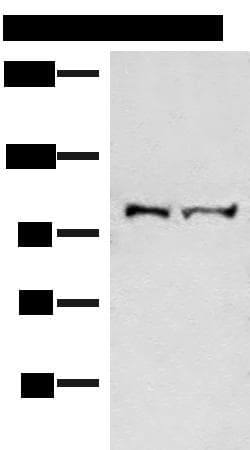EFTUD2 Antibody