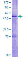 Human SPATA3 / ASARG1 Protein (Recombinant GST)