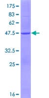 Human MCAT Protein (Recombinant GST)