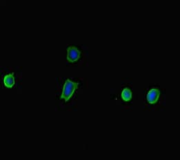 TP53INP2 Antibody