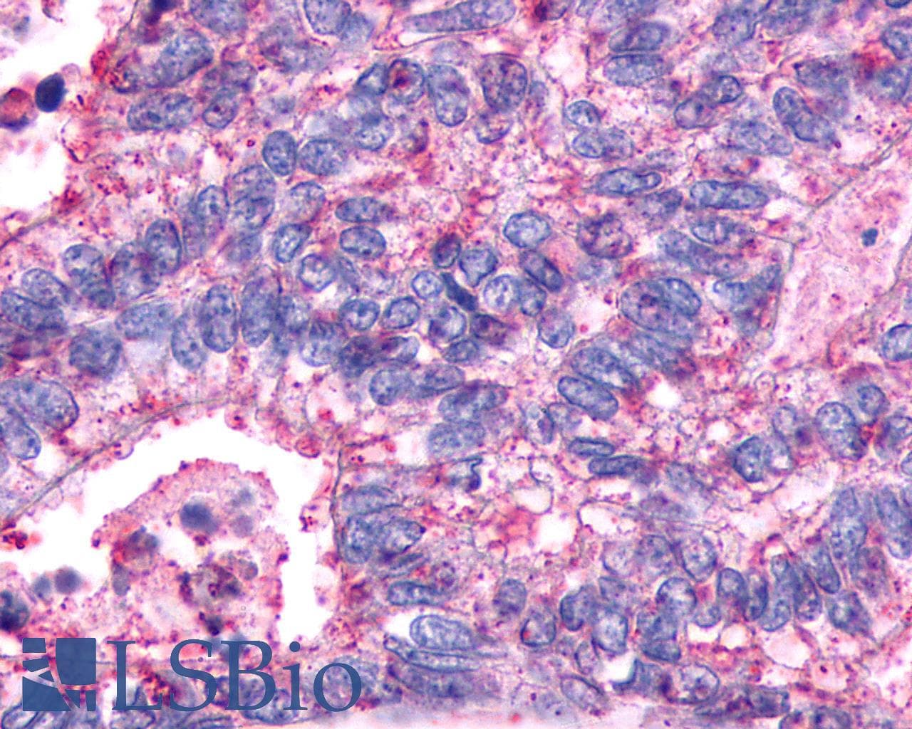 PathPlus™ AVPR2 / V2R Antibody (C-Terminus)