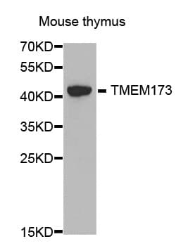 TMEM173 / STING Antibody