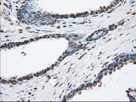 ACAT2 Antibody (clone OTI5F7)