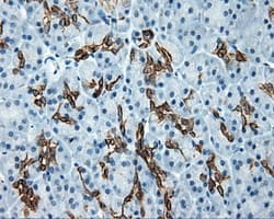 SRR / Serine Racemase Antibody (clone OTI2E3)