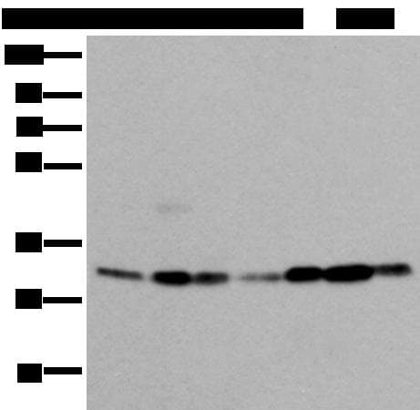 VDAC1 / PORIN Antibody