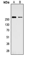 TLN1 / Talin 1 Antibody (C-Terminus)
