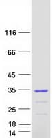Human NSMCE1 Protein (Recombinant Myc-DDK (Flag))