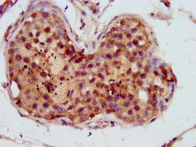 C10orf2 / PEO1 Antibody