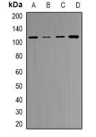 RB1 / Retinoblastoma / RB Antibody (Internal)
