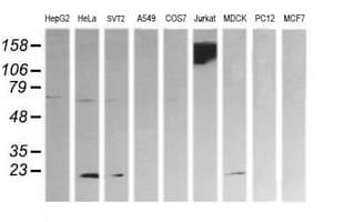 CD45 / LCA Antibody (clone OTI1B7, Carrier-free)