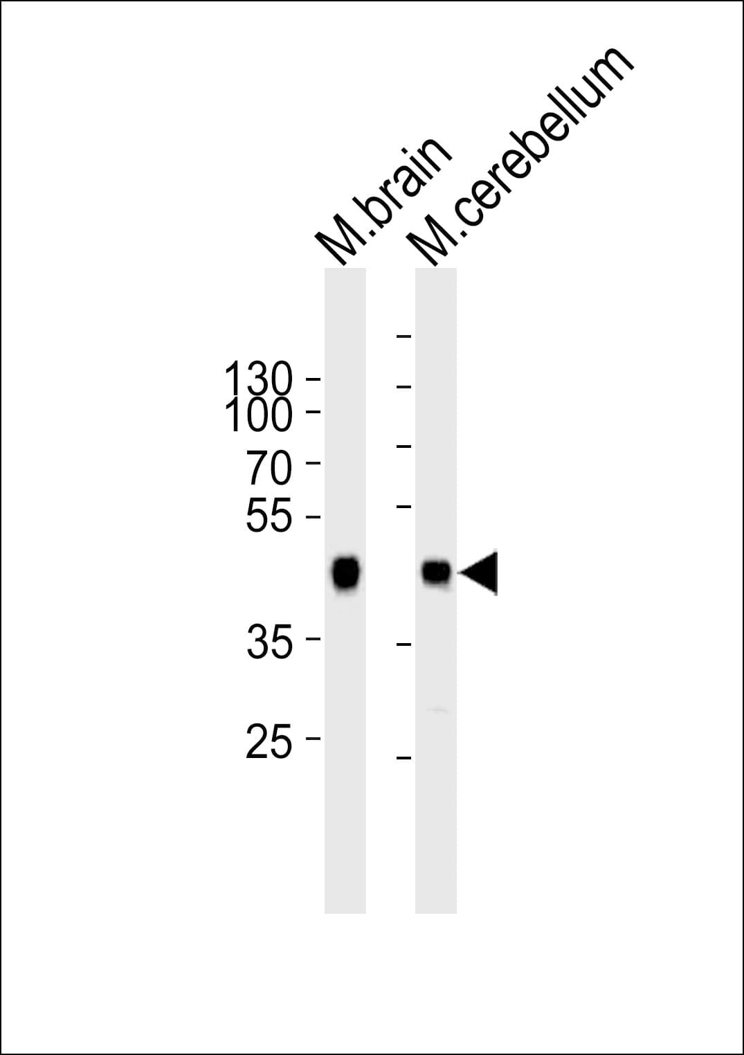 ZDHHC14 Antibody (aa283-317)