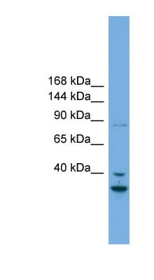 Polyclonal Rabbit anti-Human FSTL5 Antibody (aa719-768, WB)