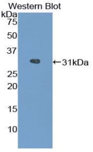 ACP5 / TRAP Antibody (aa29-296)