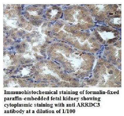 ARRDC3 Antibody (aa3-186)