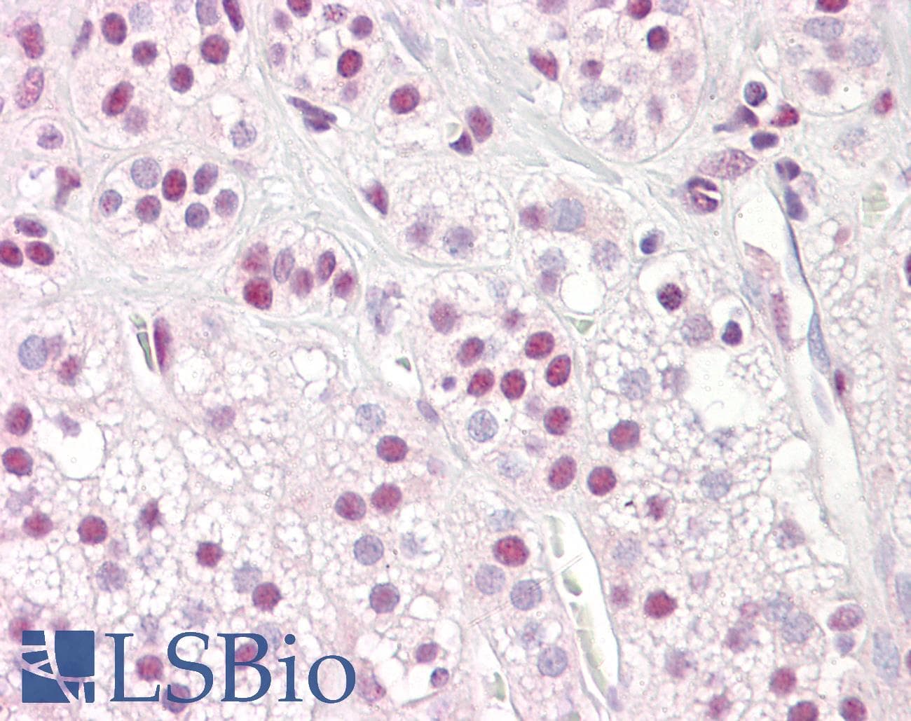 IHC-plus™ SF1 Antibody (aa48-97)