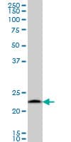 PSMB6 Antibody (clone S51)