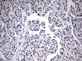 CD5 Antibody (clone OTI10F4)