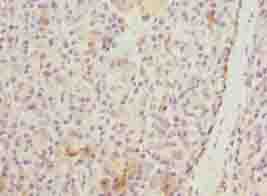 Polyclonal Rabbit anti-Human WDR74 Antibody (IHC, WB)