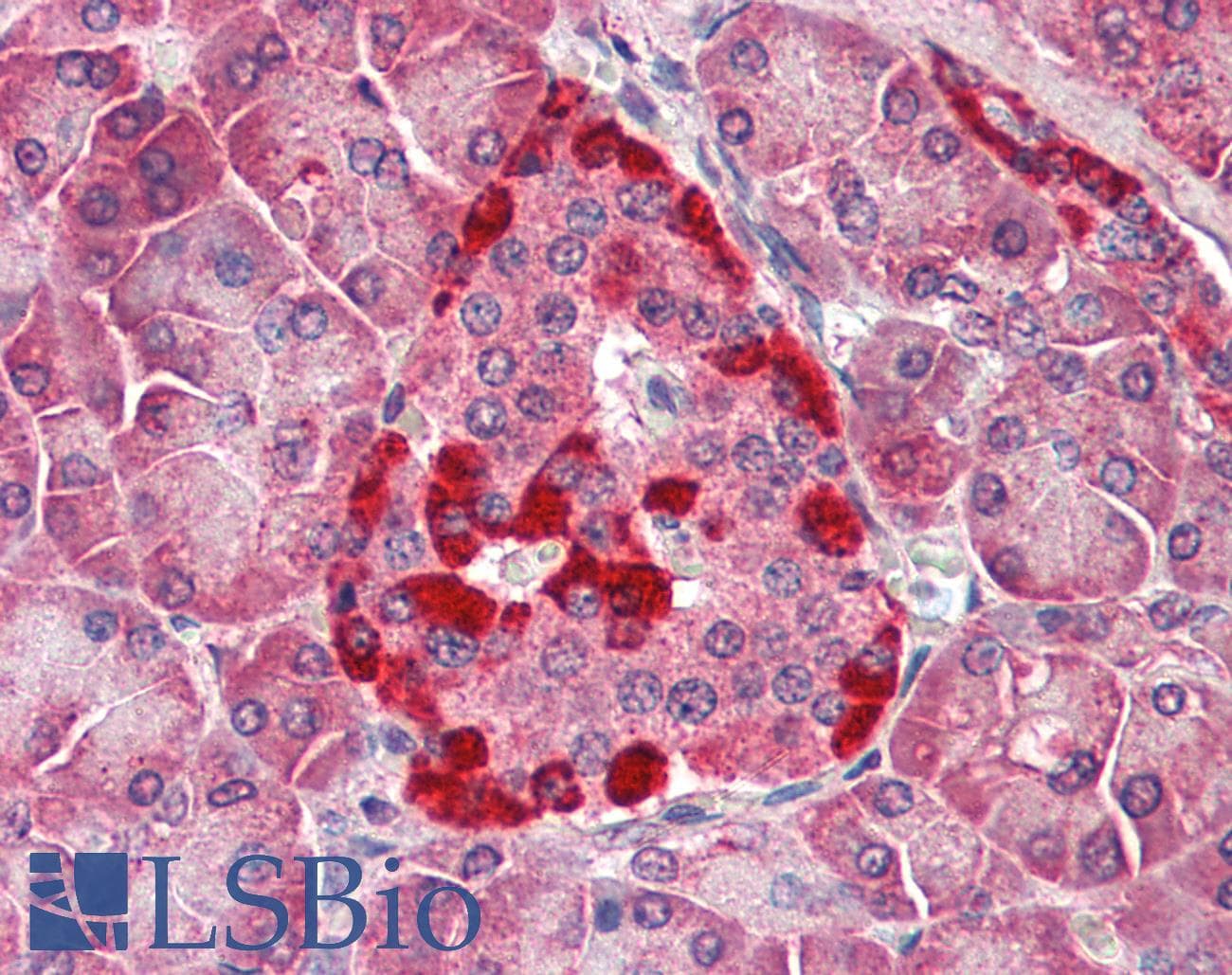 IHC-plus™ CASP1 / Caspase 1 Antibody