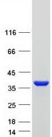Human UP / UPP1 Protein (Recombinant Myc-DDK (Flag))