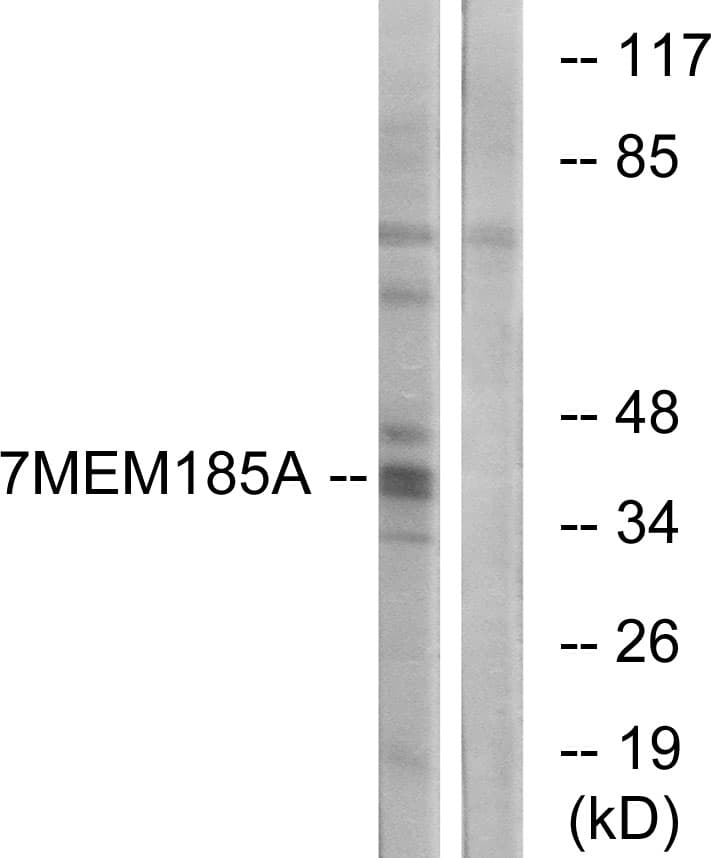 TMEM185A / FAM11A Antibody (aa290-339)
