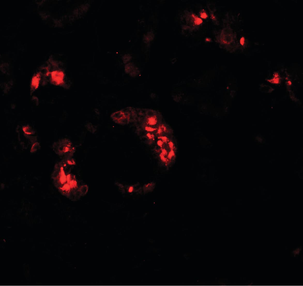 IHC-plus™ KANK2 Antibody