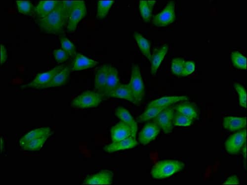 Polyclonal Rabbit anti-Human FBX09 / FBXO9 Antibody (IHC, IF)