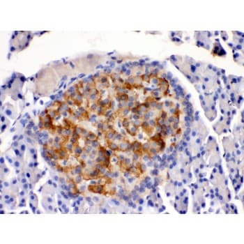 Polyclonal Rabbit anti-Human HSD2 / HSD11B2 Antibody (aa277-309, IHC, WB)