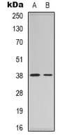 NPM1 / NPM / Nucleophosmin Antibody (C-Terminus)