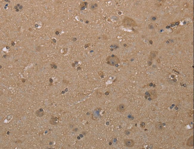 Polyclonal Rabbit anti-Human CAB39 / MO25 Antibody (IHC, WB)