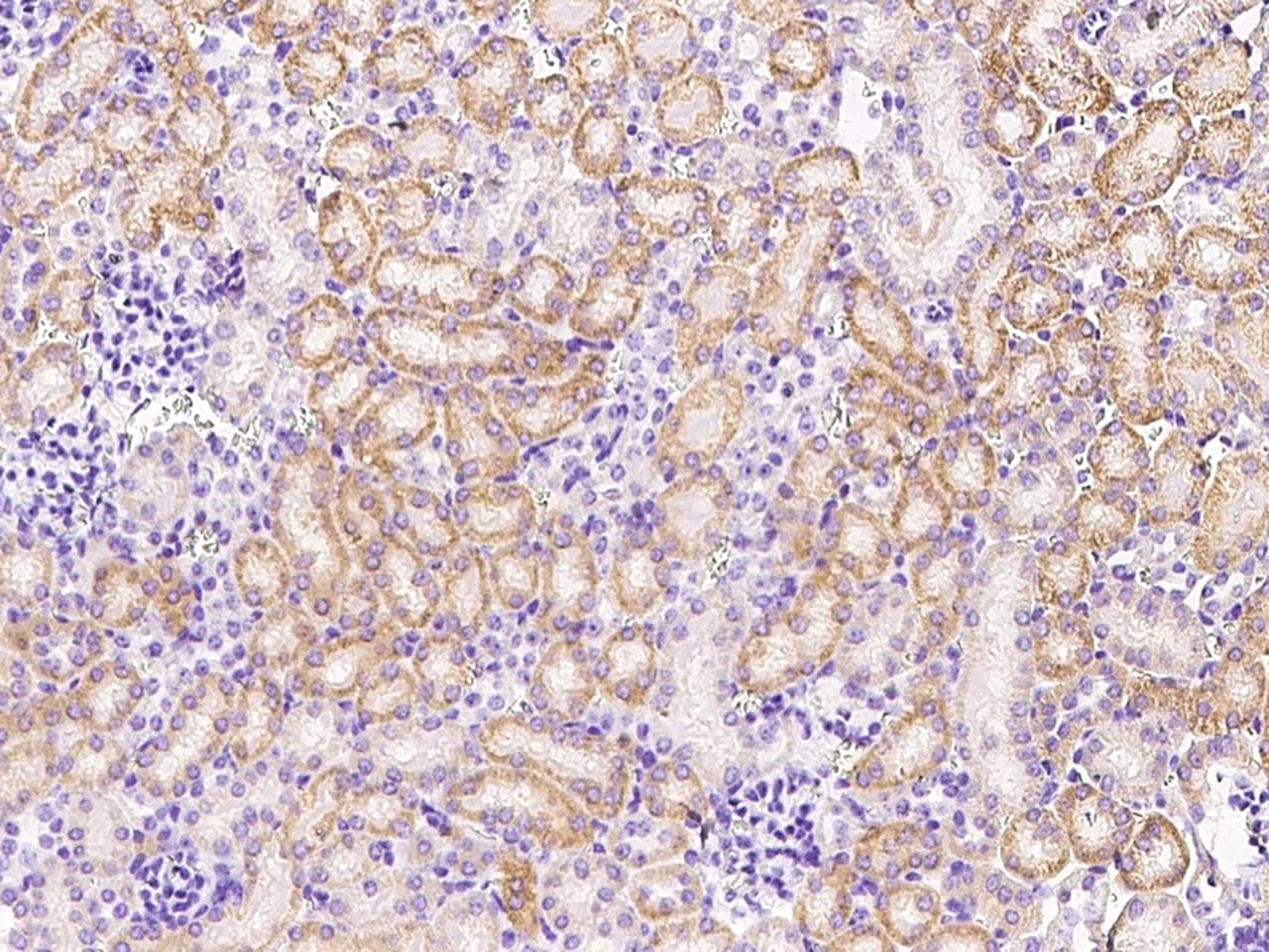 CDH3 / P-Cadherin Antibody