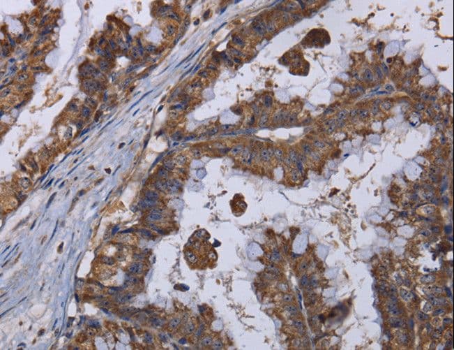 MT3 / Metallothionein 3 Antibody