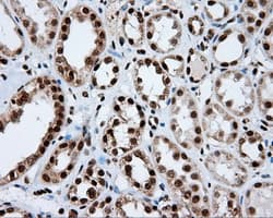 TLDC1 / KIAA1609 Antibody (clone OTI12B1)
