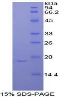 Rat POSTN / Periostin Protein (Recombinant His)