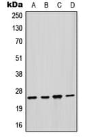 GSTM2 Antibody (Internal)
