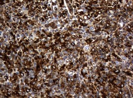 TSC22D1 / TSC22 Antibody (clone OTI2G3)
