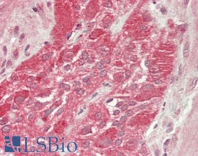 IHC-plus™ CSNK1E / CK1 Epsilon Antibody (clone 2E1)