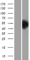 CHKA / CK / Choline Kinase Protein (Over-Expression Lysate Myc-DDK (Flag))