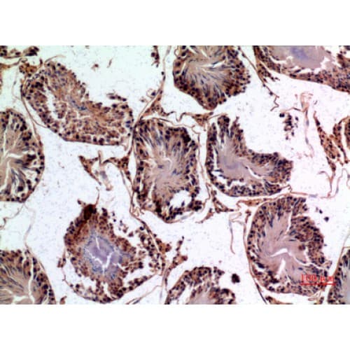 Polyclonal Rabbit anti-Human PNPLA6 / NTE Antibody (1031-1080 aa, Internal, IHC, WB)