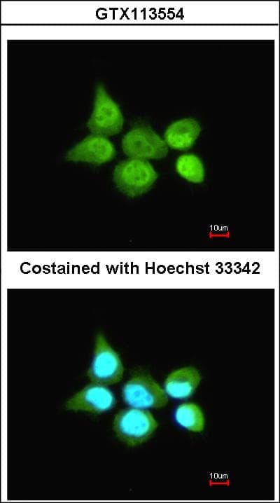 Polyclonal Rabbit anti-Human TRIM21 / RO52 Antibody (aa254-475, IHC, WB)