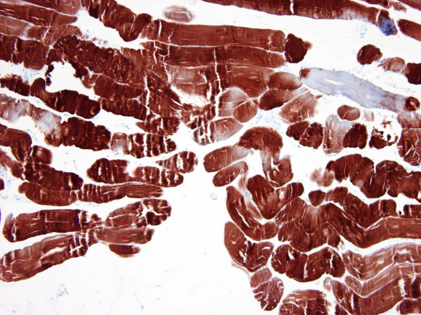 IHC-plus™ ACTA1 / Skeletal Muscle Actin Antibody (clone 3B3)