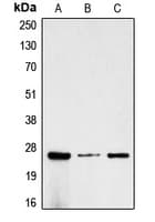 IHC-plus™ CGB / hCG Beta Antibody (C-Terminus)