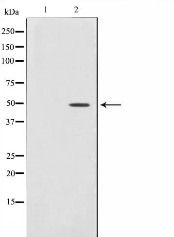 AGPAT9 / MAG1 Antibody