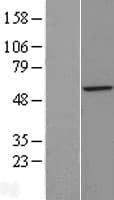 ZNF200 Protein (Over-Expression Lysate Myc-DDK (Flag))