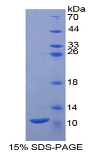 Human PKIB Protein (Recombinant His-T7)